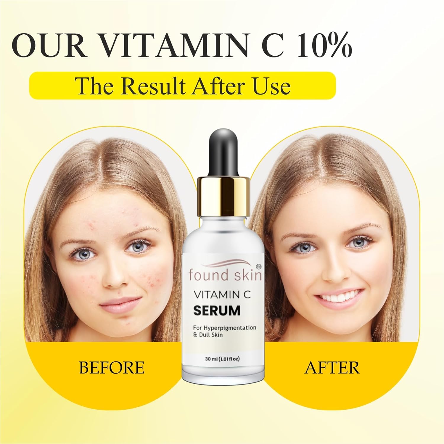 Vitamin C Serum 10% for Face – Reduces Hyperpigmentation, Dark Spots & Dull Skin | Brightening & Even Skin Tone Formula | Lightweight Fast Absorbing Facial Serum for Men & Women | Hydrating Skincare for All Skin Types | 30ml
